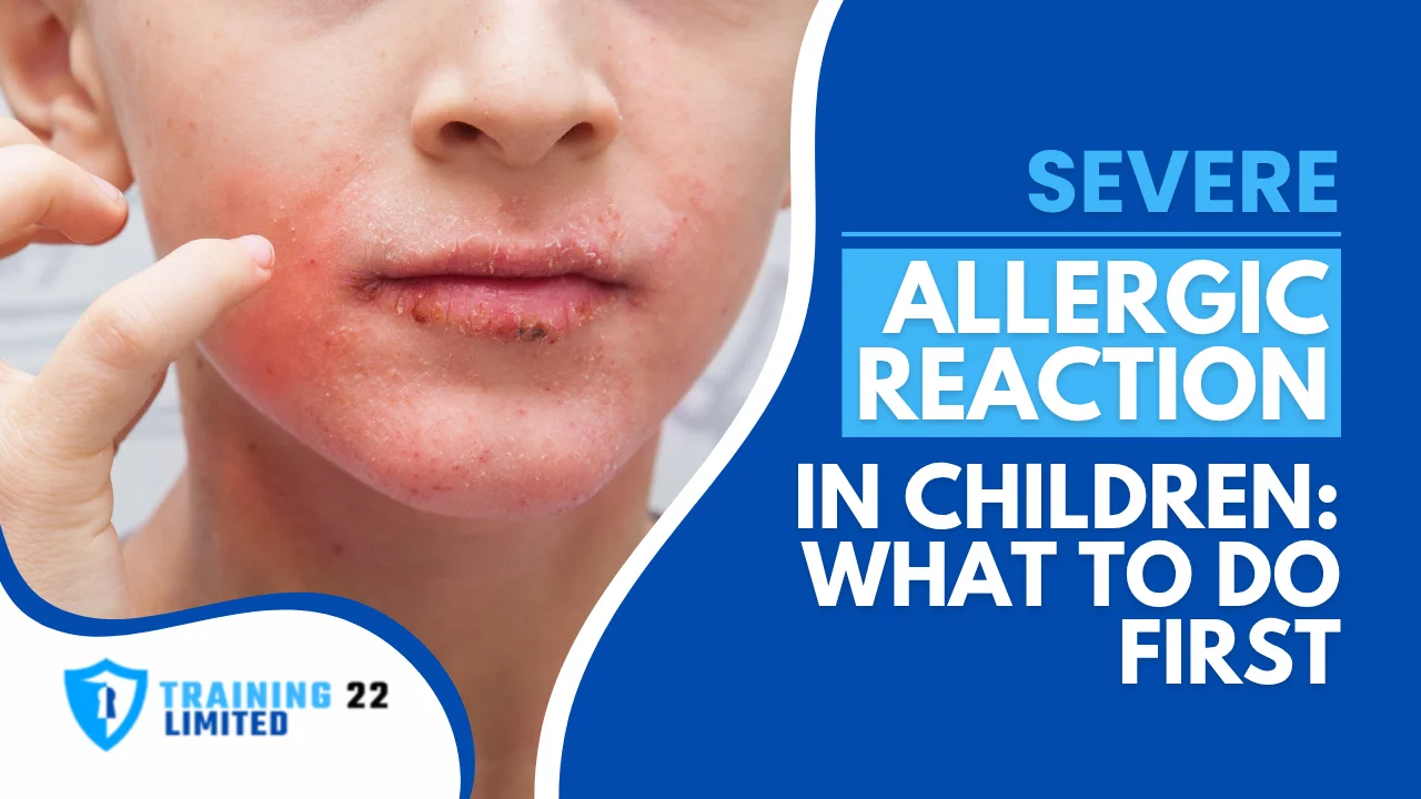 Severe Allergic Reaction in Children_ What To Do First