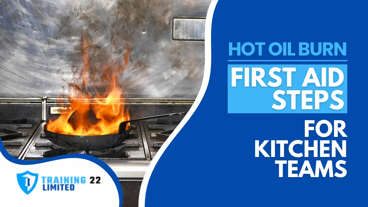 Hot Oil Burn First Aid Steps for Kitchen Teams