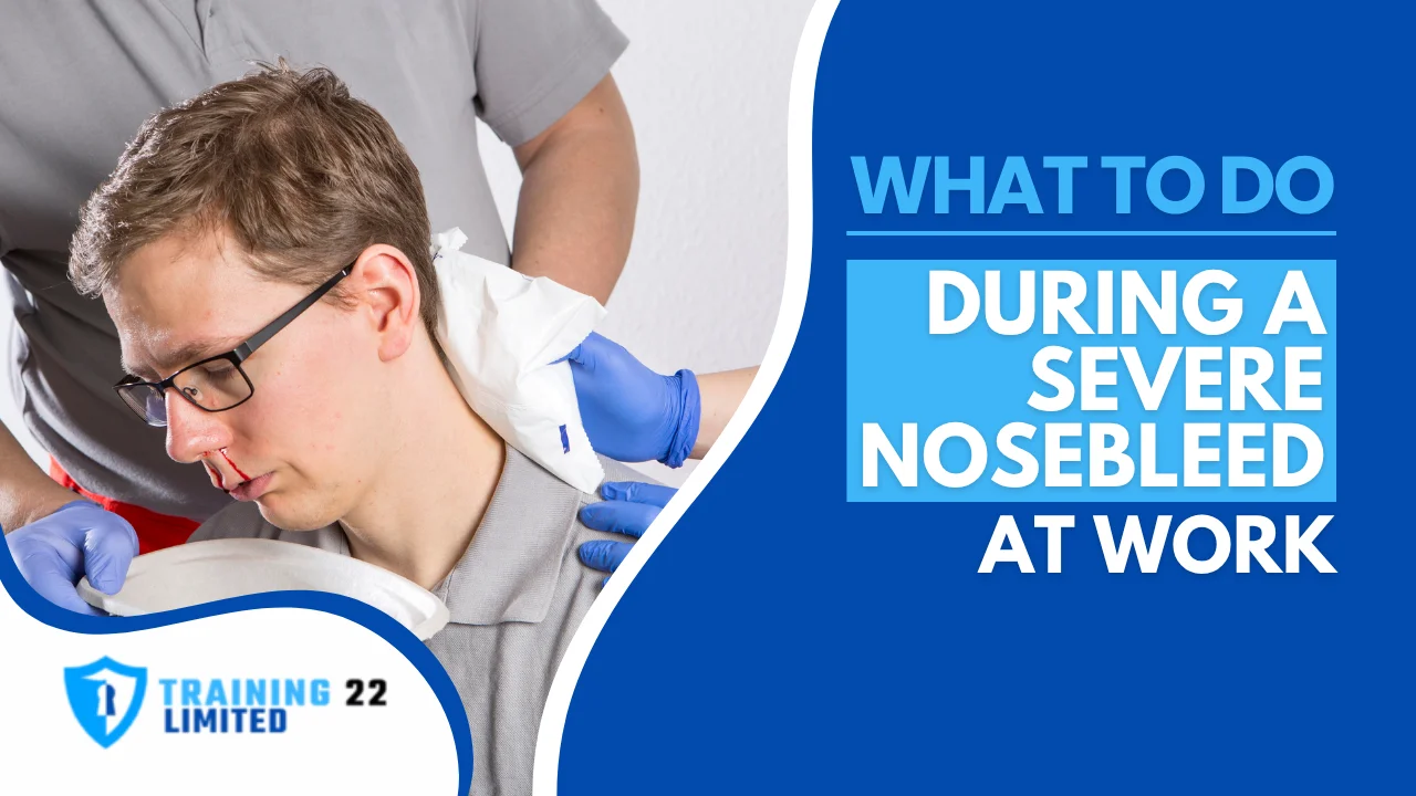 What to Do During a Severe Nosebleed at Work
